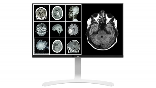 Monitor LG Clinical 27P 8MP DICOM - 27HJ712C-W